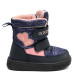 Boots IGGY, Mov